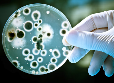 Schimmelpilze, Bakterien und Allergene stellen eine Belastung für den menschlichen Organismus dar.